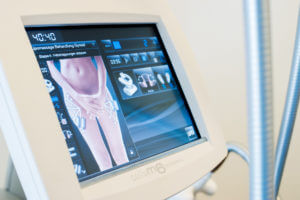 Lipomassage Green Hills Essen