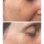 Vorher-Nachher Vergleich